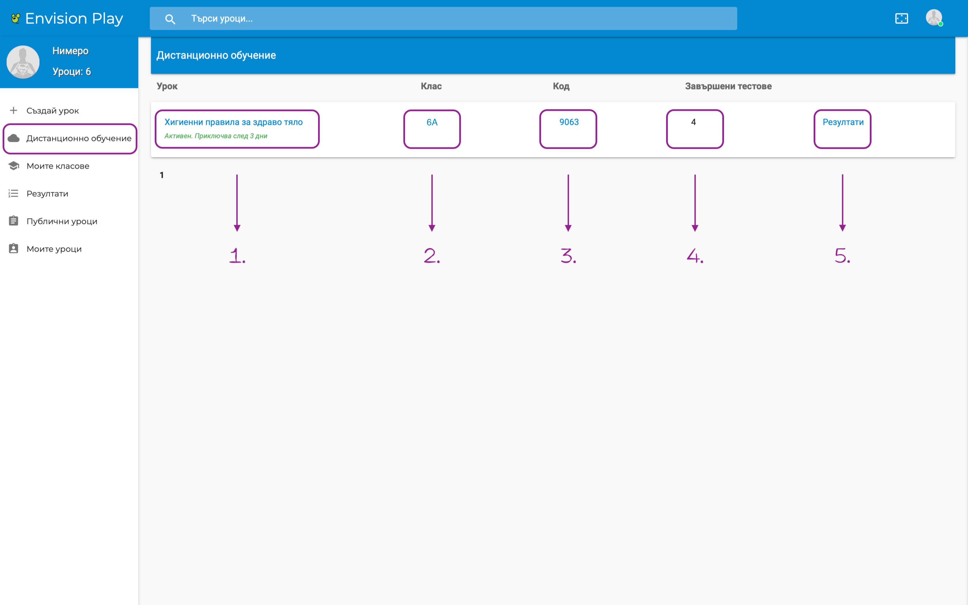 Pregled - Distancionno obuchenie
